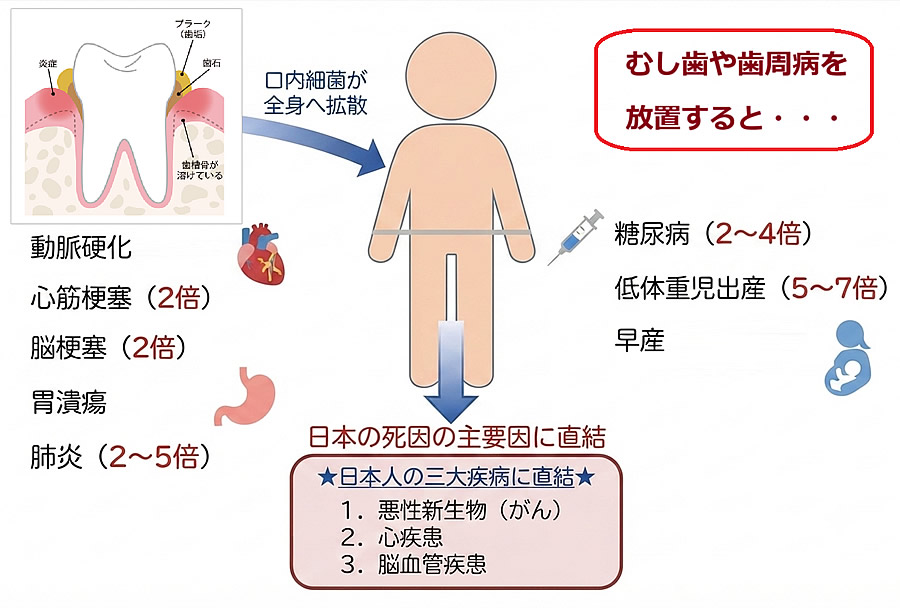 お口の中の健康と全身疾患の関係